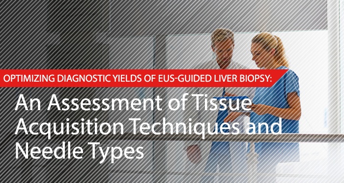 BL-009 - Diagnostics of EUS guided Liver Biopsy.jpg